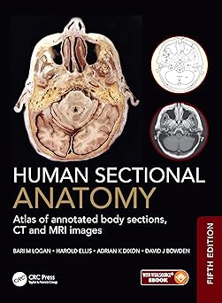 Human Sectional Anatomy: Atlas of annotated body sections, CT and MRI images -Original PDF