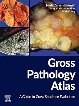 Gross Pathology Atlas: A Guide to Gross Specimens Evaluation 1st Edition-Original PDF