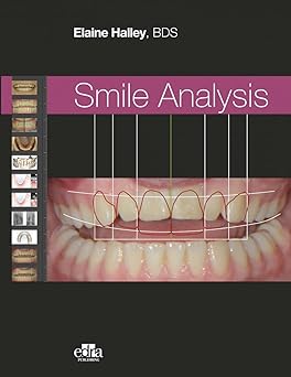 Smile Analysis -EPUB