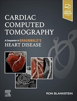 Cardiac Computed Tomography: A Companion to Braunwald's Heart Disease -True PDF