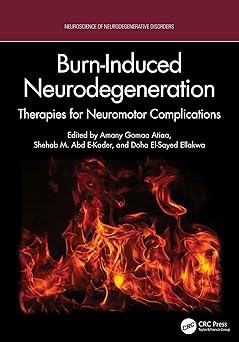 Burn-Induced Neurodegeneration: Therapies for Neuromotor Complications (Neuroscience of Neurodegenerative Disease) -EPUB