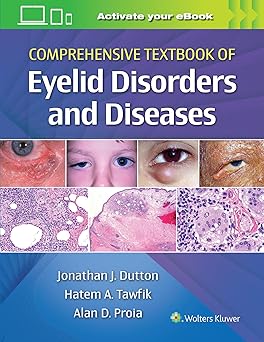 Comprehensive Textbook of Eyelid Disorders and Diseases -EPUB