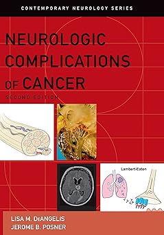 Neurologic Complications of Cancer (Contemporary Neurology Series Book 73) 2nd Edition-Original PDF