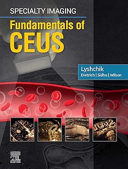 Specialty Imaging: Fundamentals of CEUS E-Book -EPUB