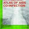 Atlas of AIDS Co-infection 1st Edition-Original PDF