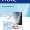 Osteosynthesis of the Hand: Instruments, Implants, and Techniques-EPUB