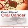 COLOR ATLAS OF ORAL CANCER-Original PDF