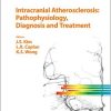 Intracranial Atherosclerosis: Pathophysiology, Diagnosis and Treatment (Frontiers of Neurology and Neuroscience, Vol. 40)-Original PDF