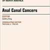 Anal Canal Cancers, An Issue of Surgical Oncology Clinics of North America, 1e (The Clinics: Surgery)-Original PDF