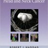 Multidisciplinary Management of Head and Neck Cancer-Original PDF