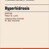 Hyperhidrosis, An Issue of Thoracic Surgery Clinics of North America, 1e (The Clinics: Surgery)-Original PDF
