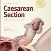 Textbook of Caesarean Section-Original PDF