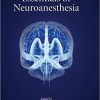 Essentials of Neuroanesthesia-Original PDF