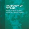 Handbook of Vitiligo: Basic Science and Clinical Management -Original PDF