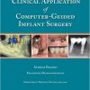 Clinical Application of Computer-Guided Implant Surgery-Original PDF