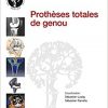 Prothèses Totales De Genou (French Edition)-Original PDF