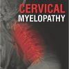 Cervical Myelopathy-Original PDF