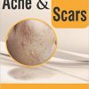 Acne & Scars-Original PDF