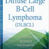 Diffuse Large B-cell Lymphoma: Symptoms, Treatment and Prognosis-Original PDF