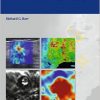 Breast Elastography -Original PDF