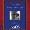 Hand and Wrist Arthritis (Monograph) (Monograph Series (American Academy of Orthopaedic Surgeons))-Original PDF