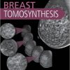 Breast Tomosynthesis, 1e-Original PDF