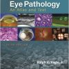 Eye Pathology: An Atlas and Text Third Edition-EPUB