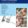 Color Atlas of Endo-Otoscopy: Examination-Diagnosis-Treatment-Original PDF