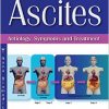 Ascites: Aetiology, Symptoms and Treatment (New Developments in Medical Research)-Original PDF