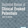 Illustrated Manual of Clinical Evoked Potentials-Original PDF
