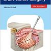 Getting Ready for Brain Tumor Surgery-Original PDF
