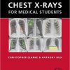 Chest X-rays for Medical Students – Original PDF