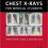 Chest X-rays for Medical Students – Original PDF