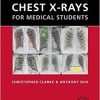 Chest X-rays for Medical Students-EPUB
