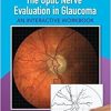 The Optic Nerve Evaluation in Glaucoma: An Interactive Workbook-EPUB