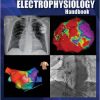 The Clinical Cardiac Electrophysiology Handbook-Original PDF