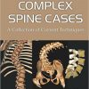 Complex Spine Cases: A Collection of Current Techniques-Original PDF