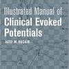 Illustrated Manual of Clinical Evoked Potentials-EPUB