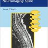Differential Diagnosis in Neuroimaging: Spine-Original PDF