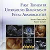 First Trimester Ultrasound Diagnosis of Fetal Abnormalities-EPUB
