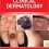 Fitzpatrick’s Color Atlas and Synopsis of Clinical Dermatology, Eighth Edition-Original PDF+Videos