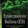 Epidermolysis Bullosa: Prevalence, Clinical Manifestations and Management-Original PDF