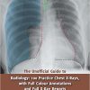 The Unofficial Guide to Radiology: 100 Practice Chest X Rays with Full Colour Annotations and Full X Ray Reports (Unofficial Guides to Medicine)-EPUB