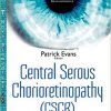 Central Serous Chorioretinopathy: Risk Factors, Diagnosis and Management-Original PDF
