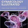 Gynaecology Illustrated, 6e-Original PDF