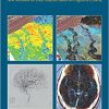 Neurobiological Background of Exploration Geosciences: New Methods for Data Analysis Based on Cognitive Criteria-Original PDF