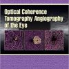 Optical Coherence Tomography Angiography of the Eye-Original PDF