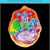Arachnoid Cysts: Epidemiology, Biology, and Neuroimaging-Original PDF