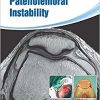 Patellofemoral Instability: Knee Joint-Original PDF