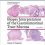 Biopsy Interpretation of the Gastrointestinal Tract Mucosa: Volume 2: Neoplastic Third edition-EPUB